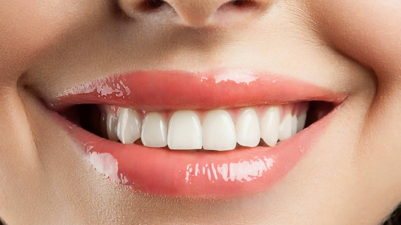 Teeth Whitening in Macon, GA Can Boost Your Confidence