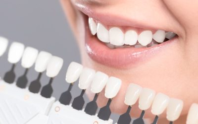 Advantages Of Visiting A Clinic For Cosmetic Dentistry In Newark NJ For Dental Veneers