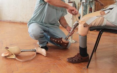 Experience Freedom And Movement With Expert Prosthetic Limb Care in Twin Falls, ID