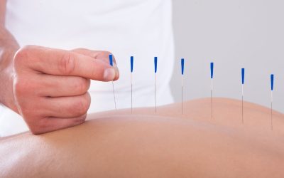 Acupuncture therapy in Midtown NYC: A traditional approach to modern health